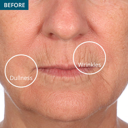 45-Day Face & 30-Day Eye Boot Camp Challenge