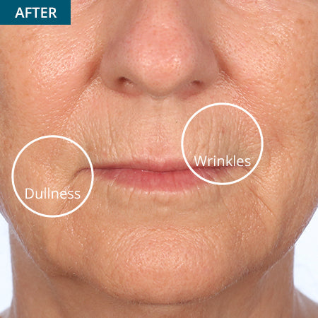 45-Day Face & 30-Day Eye Boot Camp Challenge